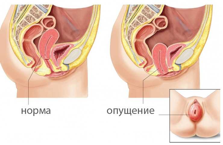 Улучшение работы мочевого пузыря — эффективные стратегии и упражнения для тренировки